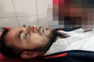 দৌলতপুরে প্রতিপক্ষের হামলায় পুলিশ কর্মকর্তা আহত