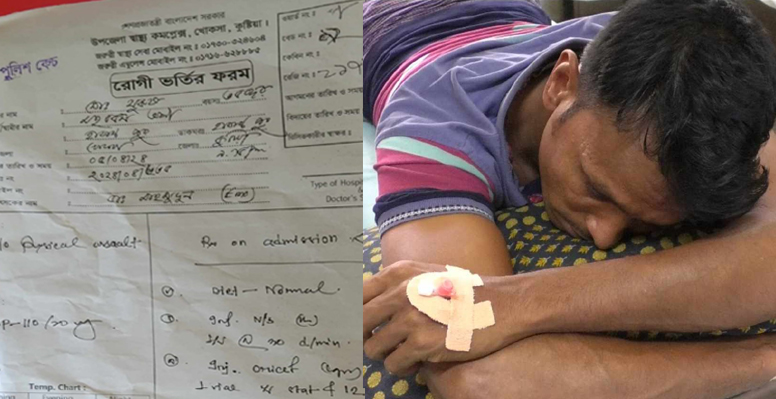 খোকসায় পুলিশের বিরুদ্ধে ভাটা শ্রমিককে চোখ বেঁধে নির্যাতনের অভিযোগ! 