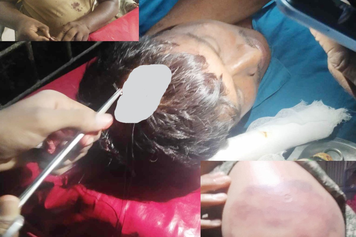 দৌলতপুরে পূর্ব শত্র“তার জের ধরে প্রতিপক্ষের উপর হামলা, আহত ৩