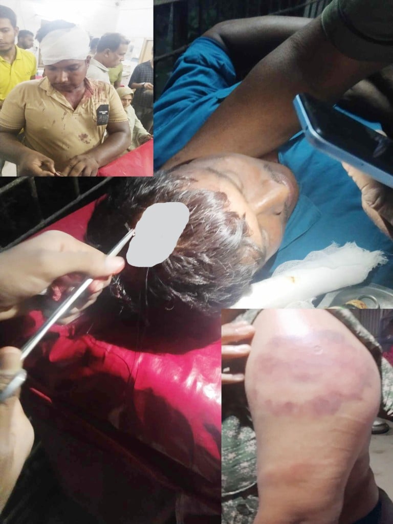 দৌলতপুরে পূর্ব শত্র“তার জের ধরে প্রতিপক্ষের উপর হামলা, আহত ৩ 4 173867920967a223a954518 দৌলতপুরে পূর্ব শত্র“তার জের ধরে প্রতিপক্ষের উপর হামলা, আহত ৩