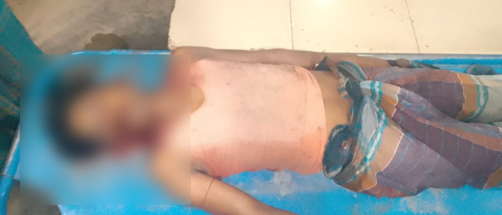 কুমারখালীতে তাল গাছ থেকে পড়ে যুবকের মৃত্যু 3 173867957267a22514232c6 কুমারখালীতে তাল গাছ থেকে পড়ে যুবকের মৃত্যু