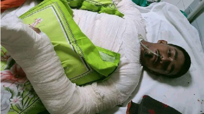 কুষ্টিয়ায় গ্যাস লাইট বিস্ফোরণে ঝলসে যাওয়া এক কিশোরের মৃত্যু