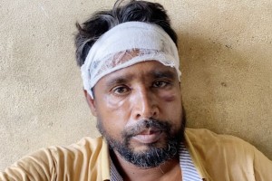 বৃদ্ধ মাকে ভাত না দেয়াকে কেন্দ্র করে ভাইয়ে ভাইয়ে সংঘর্ষ আহত-১ 