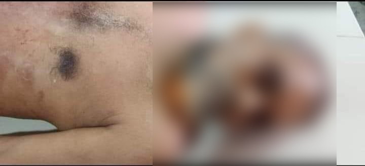 কুষ্টিয়ায় চাচাকে কুপিয়ে হত্যা
