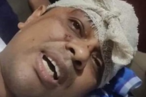 সাংবাদিক রিজুর ওপর হামলার ঘটনায় ২ দিনেও গ্রেফতার হয়নি মূল আসামিরা