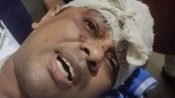সাংবাদিক রিজুর ওপর হামলার ঘটনায় ২ দিনেও গ্রেফতার হয়নি মূল আসামিরা