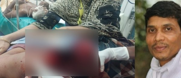 দৌলতপুরে অটোচালককে কুপিয়ে দুই হাত বিচ্ছিন্ন