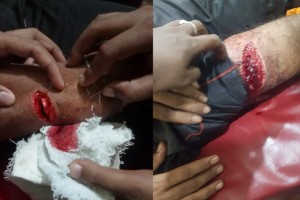 দৌলতপুরের জয়রামপুরে যুবককে কুপিয়ে মারাত্বক জখম 