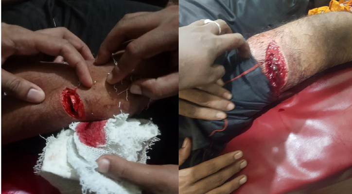 দৌলতপুরের জয়রামপুরে যুবককে কুপিয়ে মারাত্বক জখম 