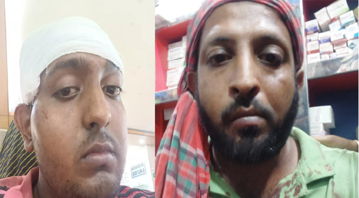 দৌলতপুরে প্রতিপক্ষের হামলায় সহোদর ভাই আহত