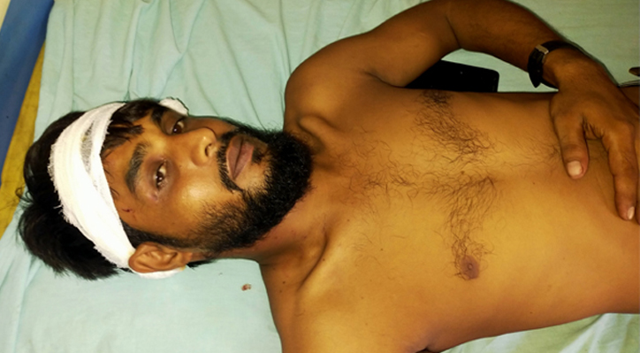 কুমারখালীতে আধিপত্য বিস্তারকে কেন্দ্র করে দু’পক্ষের সংঘর্ষে আহত ৩