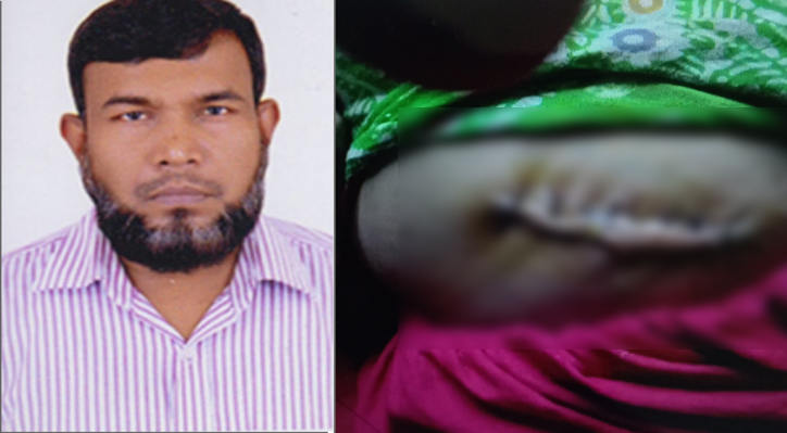 ভুল চিকিৎসায় মৃত্যুর দ্বারপ্রান্তে ভুক্তভোগী শাম্মি আক্তার