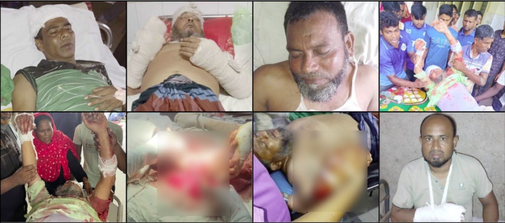 মিরপুরে আধিপত্য বিস্তারকে কেন্দ্র করে বিএনপির দুই গ্রুপের সংঘর্ষে আহত ৯ 4 173868078867a229d448007 মিরপুরে আধিপত্য বিস্তারকে কেন্দ্র করে বিএনপির দুই গ্রুপের সংঘর্ষে আহত ৯
