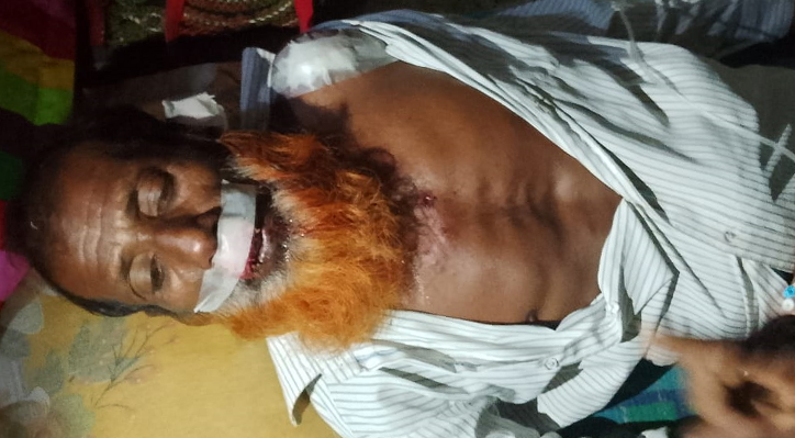 দৌলতপুরে তুচ্ছ ঘটনাকে কেন্দ্র করে সংঘর্ষে আহত ছয়