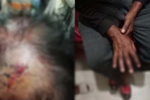 কুষ্টিয়ায় রাস্তা দখলের প্রতিবাদ করায় প্রতিবেশীর উপর হামলা 