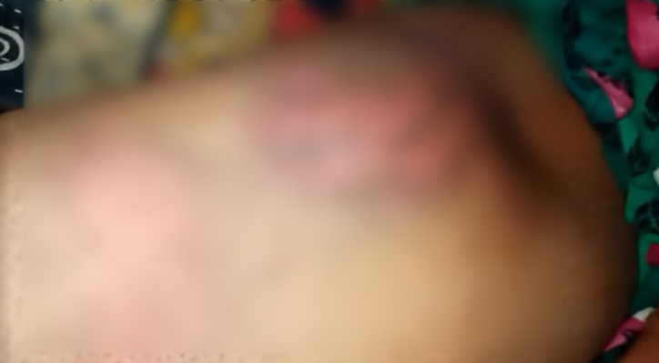 কুষ্টিয়ায় গৃহবধূর উপর সংঘবদ্ধ হামলা 