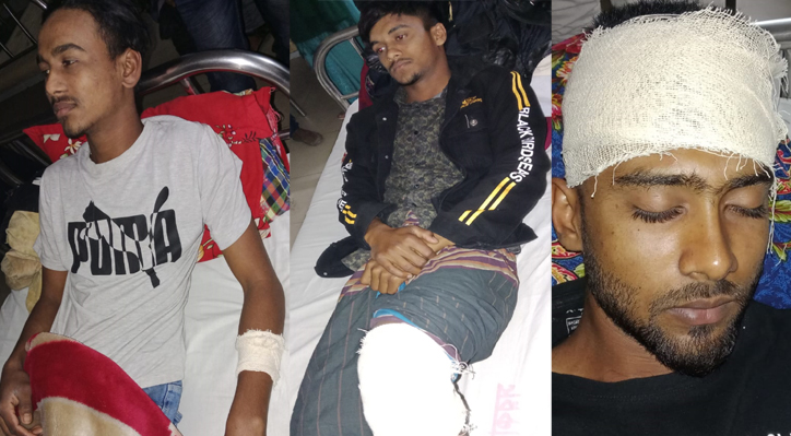 মিরপুরে ছাত্রদলের ৩ কর্মীর উপরে জয় বাংলা স্লোগান দিয়ে হামলা