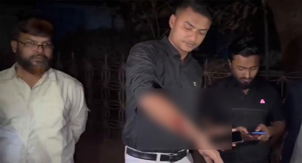 গাজীপুরে বৈষম্যবিরোধী ছাত্রদের লক্ষ্য করে গুলি, আহত ১ 4 1739024981 গাজীপুরে বৈষম্যবিরোধী ছাত্রদের লক্ষ্য করে গুলি, আহত ১