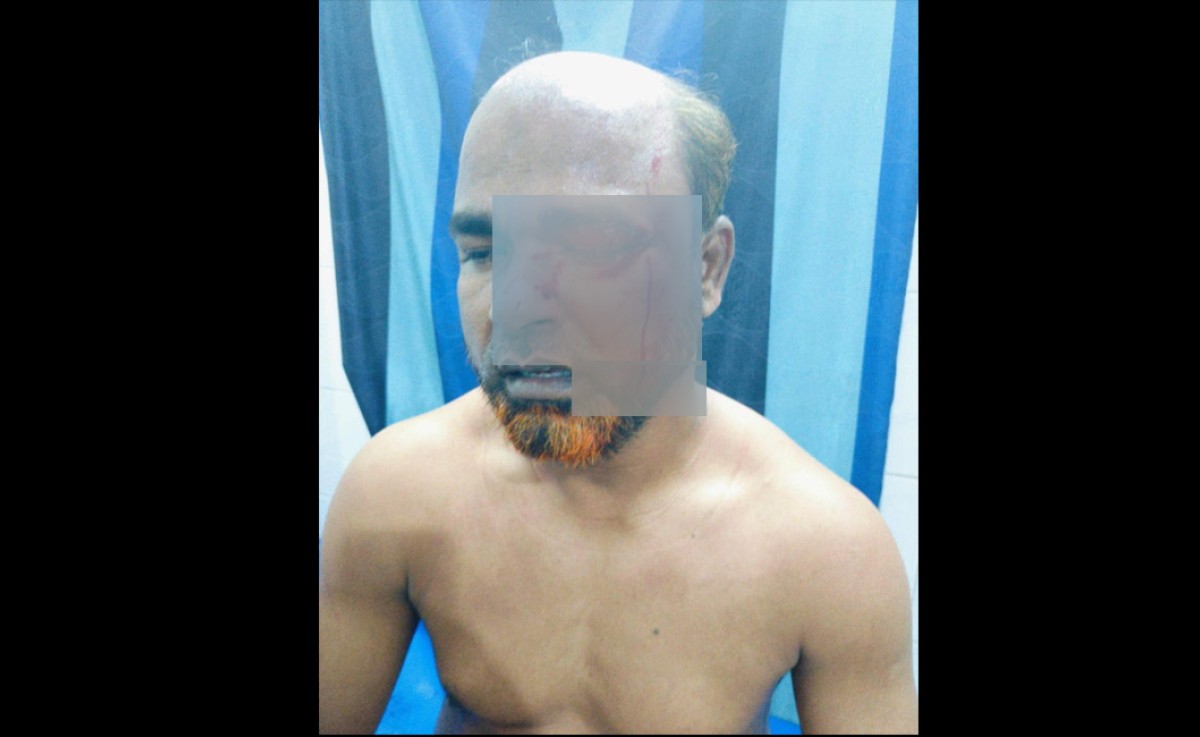 বগুড়ায় নাগরিক ঐক্যের আহ্বায়ককে দুর্বৃত্তের ছুরিকাঘাত