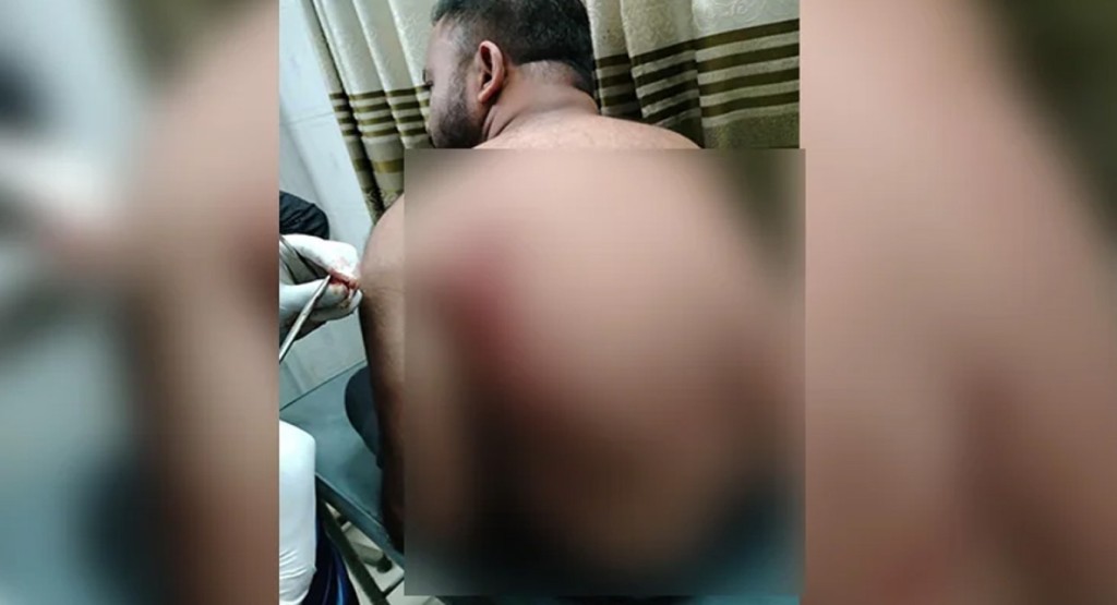 ফুল দেওয়াকে কেন্দ্র করে বিএনপির দুই পক্ষে সংঘর্ষ, ক্ষুরে আহত ২ 3 ক্ষুর 1740144688 ফুল দেওয়াকে কেন্দ্র করে বিএনপির দুই পক্ষে সংঘর্ষ, ক্ষুরে আহত ২