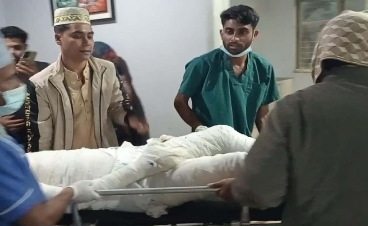 অগ্নিকাণ্ডে বোনের পর ভাইয়ের মৃত্যু; ৯ জন চিকিৎসাধীন