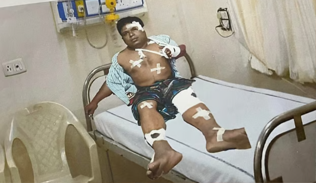 ফটোশপের মাধ্যমে আহত দেখিয়ে জুলাই ফাউন্ডেশনে প্রতারণার অভিযোগ 4 DECEIVE 1741776126 ফটোশপের মাধ্যমে আহত দেখিয়ে জুলাই ফাউন্ডেশনে প্রতারণার অভিযোগ