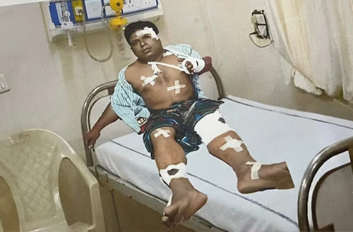 ফটোশপের মাধ্যমে আহত দেখিয়ে জুলাই ফাউন্ডেশনে প্রতারণার অভিযোগ