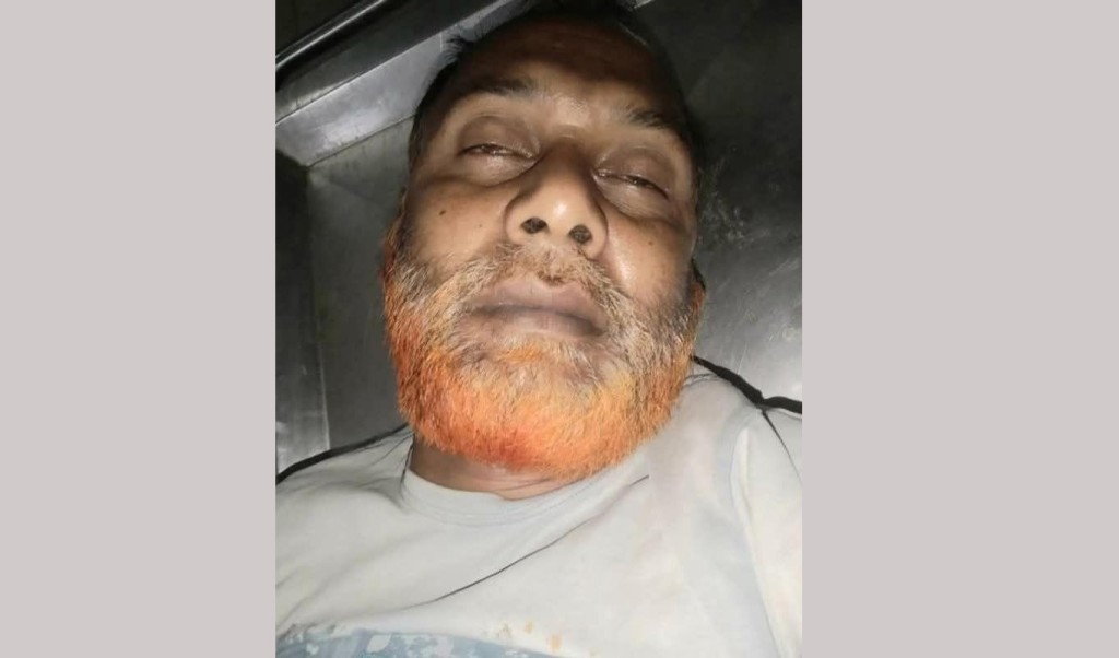 বগুড়া কারাগারে আরও এক আওয়ামী লীগ নেতার মৃত্যু 2 Untitled 3 1741696565 বগুড়া কারাগারে আরও এক আওয়ামী লীগ নেতার মৃত্যু