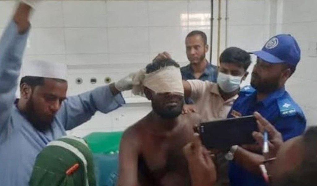 ভোলায় চোর সন্দেহে হাত-পা ভেঙে চোখ তুলে নিলো গ্রামবাসী 3 Untitled 6 1740977440 ভোলায় চোর সন্দেহে হাত-পা ভেঙে চোখ তুলে নিলো গ্রামবাসী
