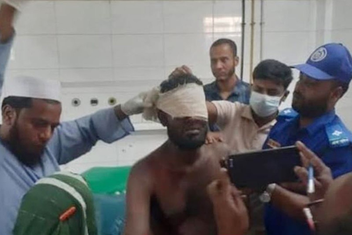 ভোলায় চোর সন্দেহে হাত-পা ভেঙে চোখ তুলে নিলো গ্রামবাসী