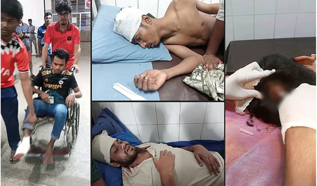 মধ্যরাতে জগন্নাথ বিশ্ববিদ্যালয়ের শিক্ষার্থীদের মারধর–হামলা 4 jogo 1741069323 মধ্যরাতে জগন্নাথ বিশ্ববিদ্যালয়ের শিক্ষার্থীদের মারধর–হামলা