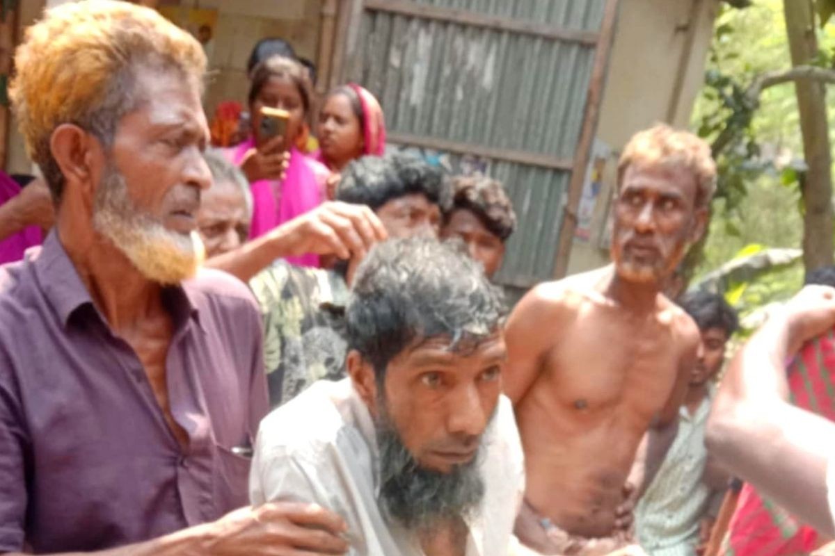 জামালপুরে ভিক্ষা চাওয়ায় ভিক্ষুকের কান ছিঁড়ে ফেলার অভিযোগ, যুবক আটক