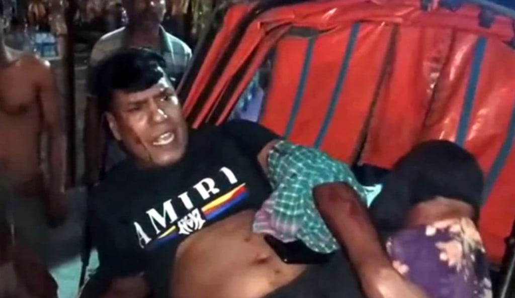 আ. লীগ নেতা 1745466890 রাজশাহীতে আ. লীগ নেতাকে গুলি, কুপিয়ে জখম