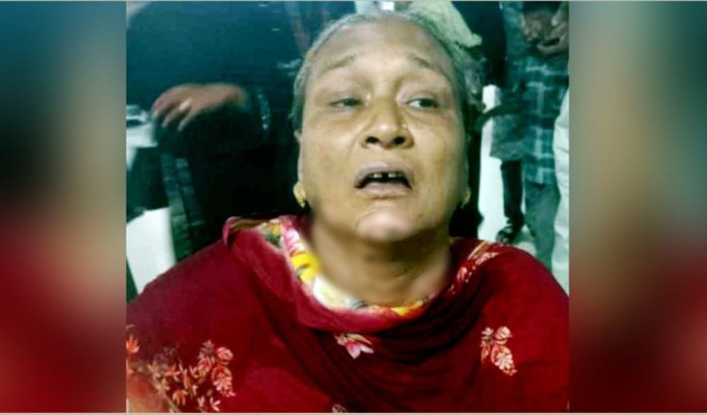 পেট্রোলবোমা নিক্ষেপ দগ্ধ দুই নারী 1745132433 চট্টগ্রামে সিএনজিচালিত অটোরিকশায় পেট্রোলবোমা নিক্ষেপ, দগ্ধ দুই নারী