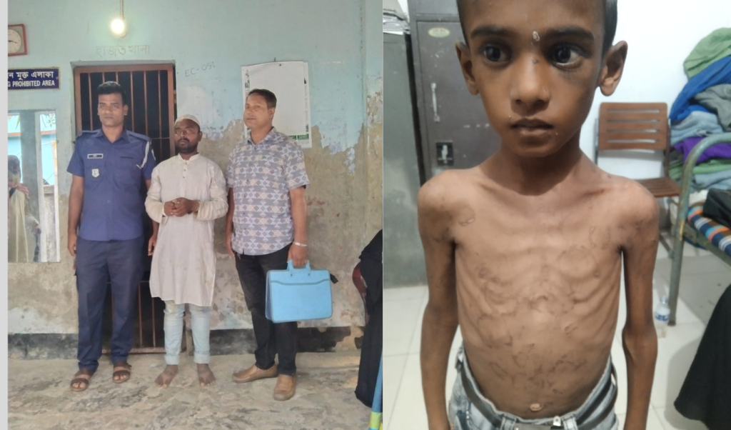 শিশু অপরহণ 1745317245 শিশু অপহরণ: শরীরের চামড়া-নখ তুলে করানো হতো ভিক্ষা