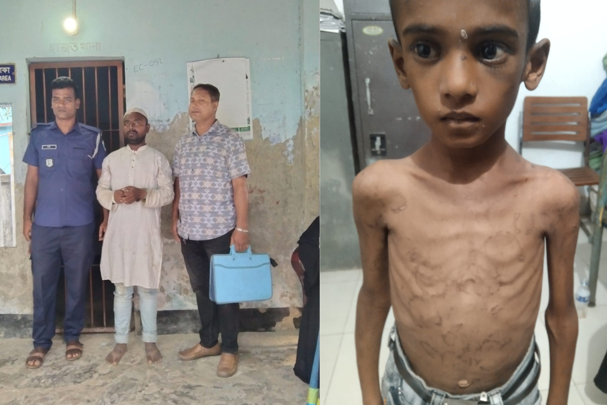 শিশু অপহরণ: শরীরের চামড়া-নখ তুলে করানো হতো ভিক্ষা