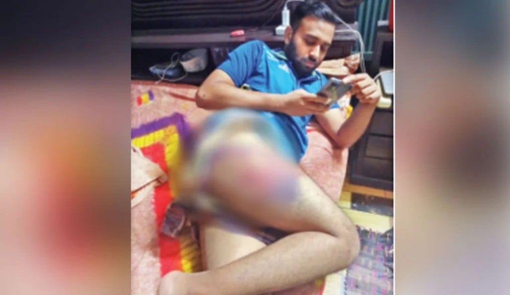 সম্বনয়ককে পুলিশ সদস্যে মারধর 1745070401 ‘সমন্বয়ক’ পরিচয় শুনে বেশি মেরেছে