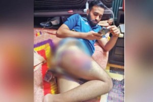 ‘সমন্বয়ক’ পরিচয় শুনে বেশি মেরেছে