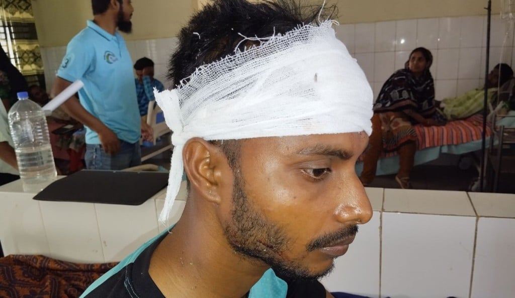 সেচ পাম্প নিয়ে সংঘর্ষে আহত ব্যক্তি 1744815937 কুমারখালীতে সেচ পাম্প নিয়ে দু’পক্ষের সংঘর্ষে আহত ৯