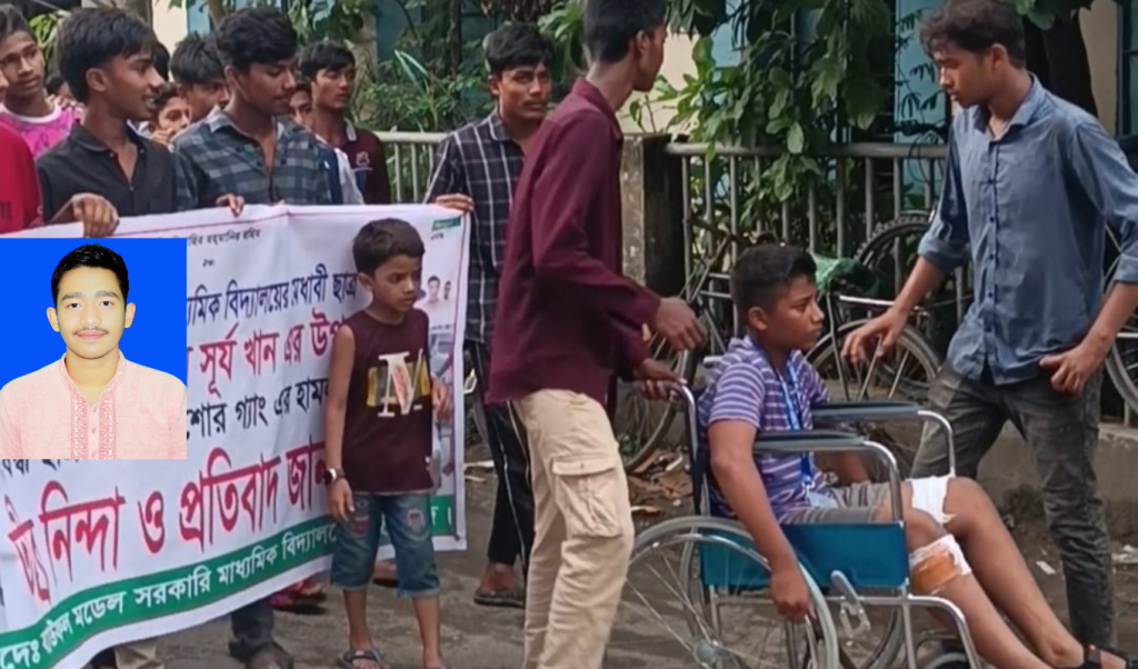 ছোট ভাইকে পেটানোর বিচার চাওয়ায় বড় ভাইকে কুপিয়ে রগ কেটে দিল সন্ত্রাসীরা 3 Untitled design 63 1747857186 ছোট ভাইকে পেটানোর বিচার চাওয়ায় বড় ভাইকে কুপিয়ে রগ কেটে দিল সন্ত্রাসীরা