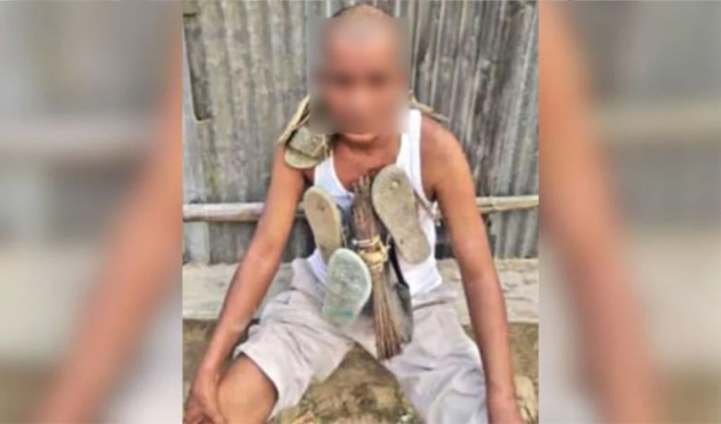 আ. লীগ নেতাকে মাথা ন্যাড়া করে জুতার মালা পরিয়ে পুলিশে সোপর্দ 1747576730 আ. লীগ নেতাকে মাথা ন্যাড়া করে জুতার মালা পরিয়ে পুলিশে সোপর্দ
