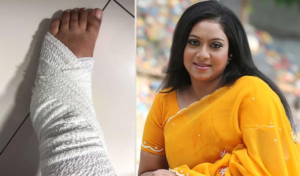 আহত শাবনুর 1747209956 রাস্তায় পড়ে গিয়ে আহত শাবনূর