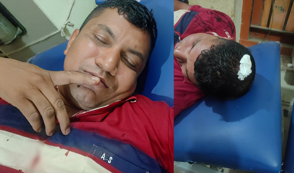 দুই পুলিশকে হাতুড়িপেটা করলো আসামি 1746256540 দুই পুলিশকে হাতুড়িপেটা করলো আসামি