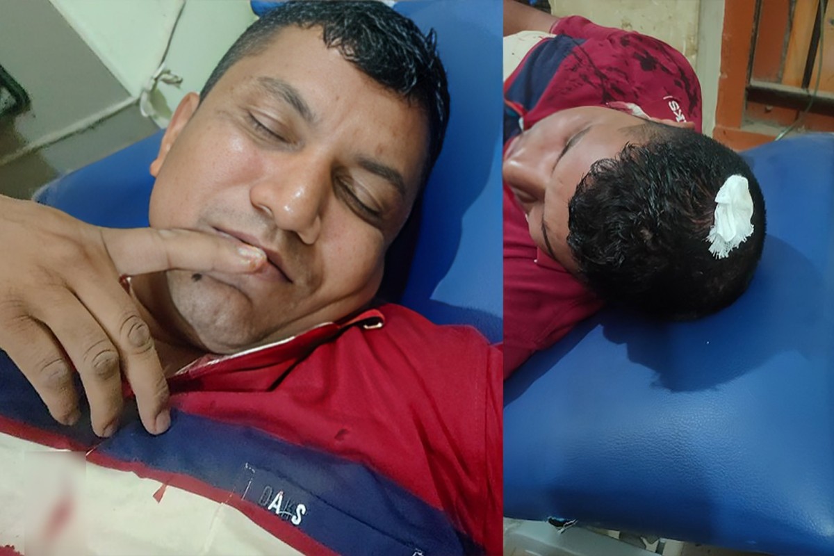 দুই পুলিশকে হাতুড়িপেটা করলো আসামি