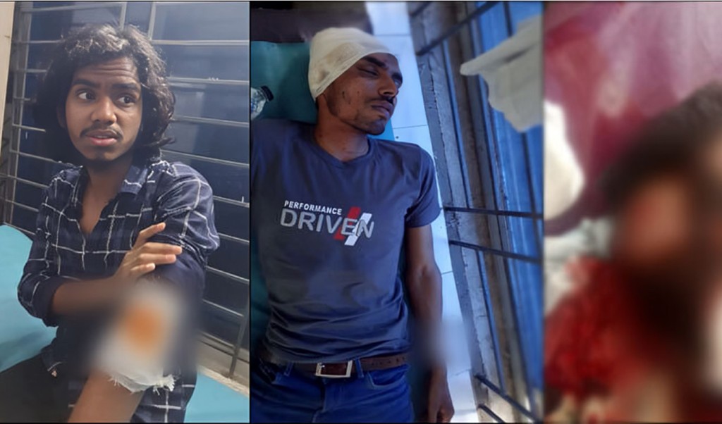 ভিজিএফ কার্ড বিতরণে বিএনপি-জামায়াতের সংঘর্ষে আহত ৭ 2 ভিজিএফ কার্ড 1748238055 ভিজিএফ কার্ড বিতরণে বিএনপি-জামায়াতের সংঘর্ষে আহত ৭