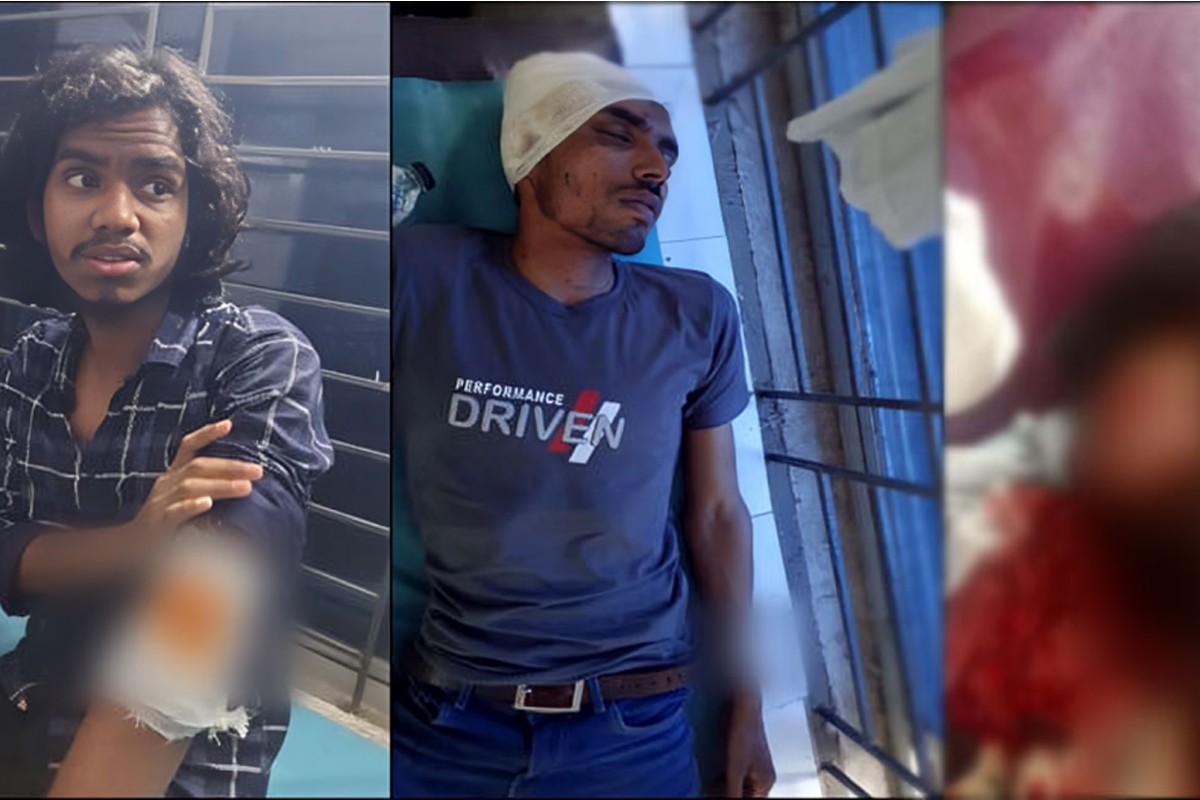 ভিজিএফ কার্ড বিতরণে বিএনপি-জামায়াতের সংঘর্ষে আহত ৭