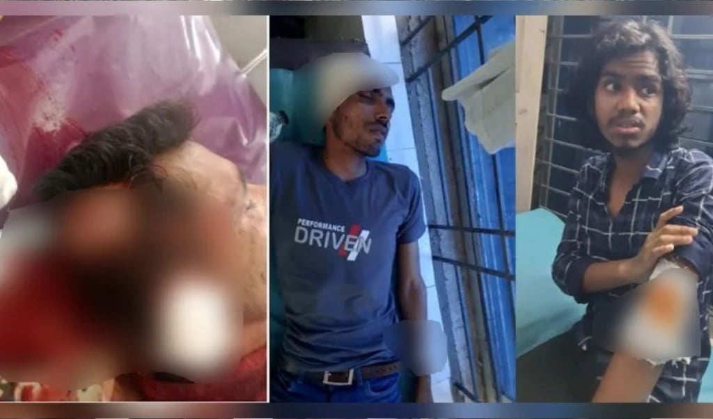 ভিজিএফের চাল বিতরণকে কেন্দ্র করে বিএনপি জামায়াতের পাল্টাপাল্টি হামলা আহত ৭ 1748186316 ভিজিএফের চাল বিতরণকে কেন্দ্র করে বিএনপি-জামায়াতের পাল্টাপাল্টি হামলা, আহত ৭