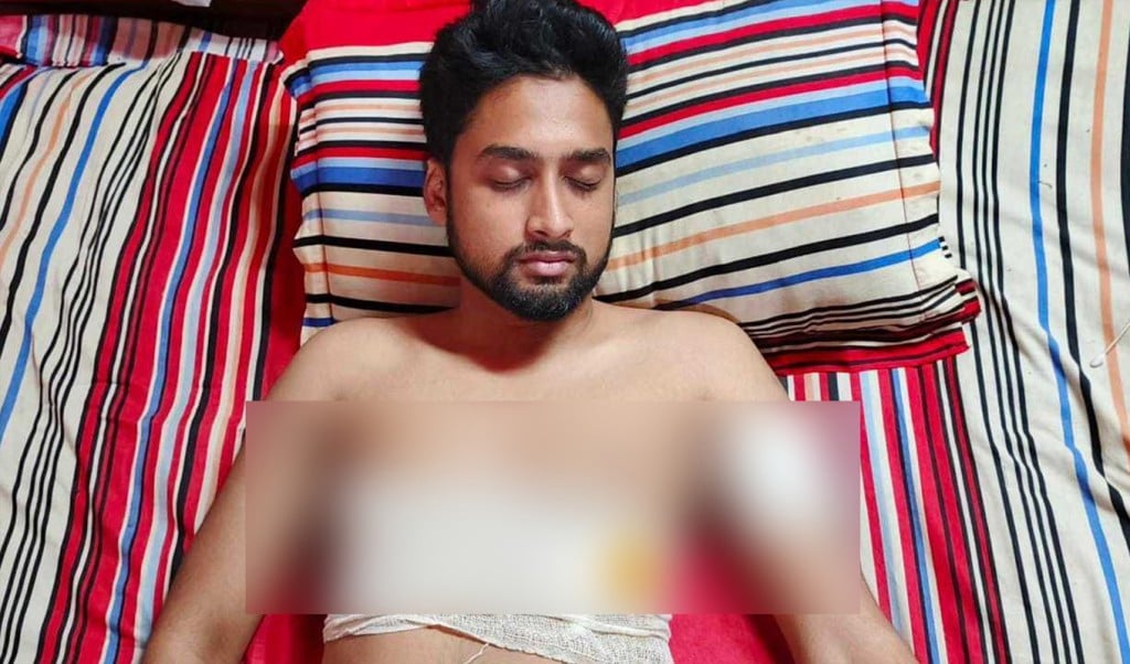 মাদক ব্যবসায় বাধা দেওয়ায় যুবককে কোপানোর অভিযোগ 1746937106 মাদক ব্যবসায় বাধা দেওয়ায় যুবককে কোপানোর অভিযোগ