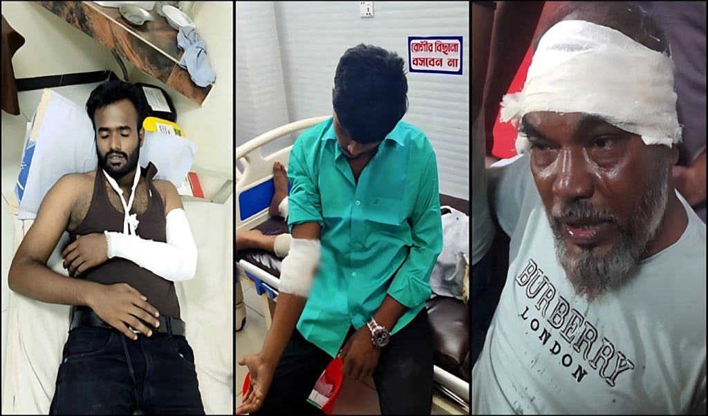 চট্টগ্রামে বিএনপির দুইপক্ষে পাল্টাপাল্টি হামলায় আহত ১৫ 1751271121 চট্টগ্রামে বিএনপির দুইপক্ষের পাল্টাপাল্টি হামলায় আহত ১৫
