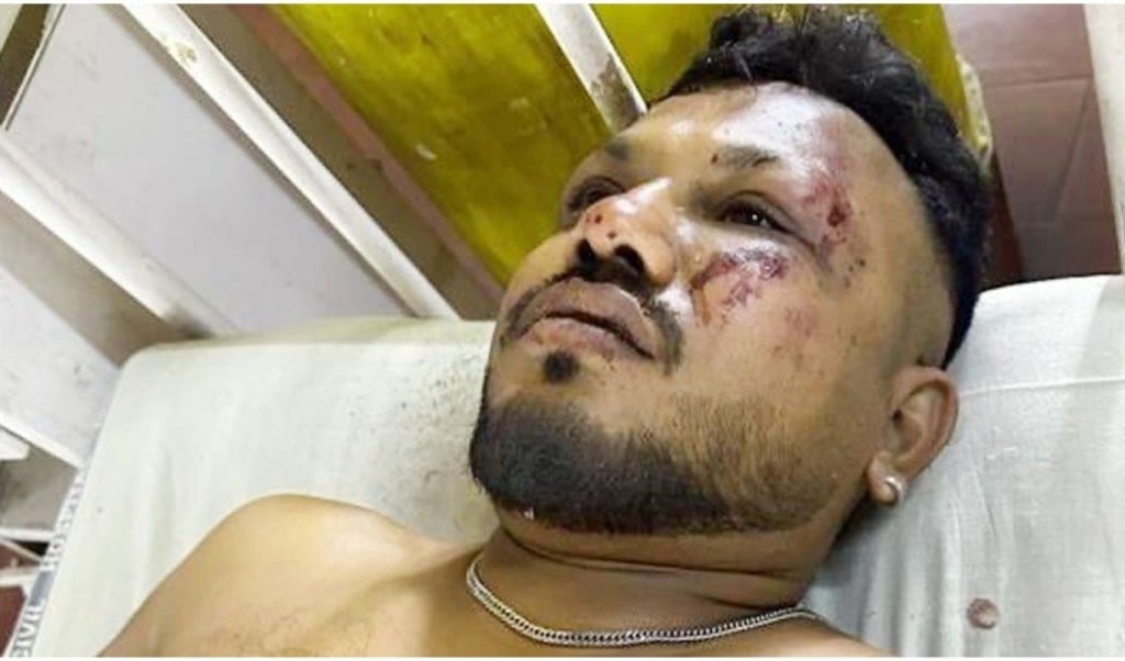 বিমান বিধ্বস্তে ২৪১ জনের নিহত অলৌকিকভাবে বেঁচে গেলেন এক যুবক 1749741149 বিমান বিধ্বস্তে ২৪১ জন নিহত, অলৌকিকভাবে বেঁচে গেলেন এক যুবক